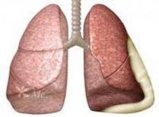 Akciğer Hastalıkları Bitkisel Tedavi