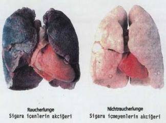 Akciğer Temizliği Hakkında Bilgi