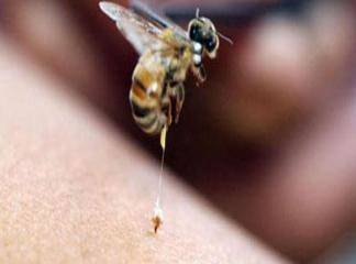 Arı Sokması Hastalığı