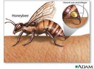Arı Sokması Şişliği Nasıl İner
