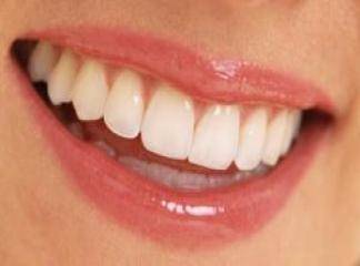 Dişlerde Kemik Erimesi