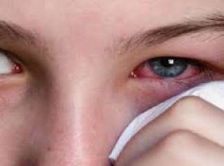 göz hastalığı çeşitleri