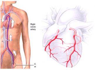 Kalp kateterizasyonu ve anjiyografinin yerini tutabilecek alternatif tetkik yöntemleri mevcut mudur?