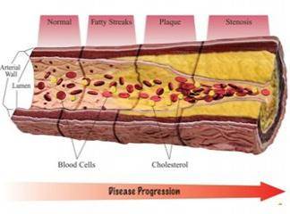 ldl kolesterol nedir nasıl düşürülür