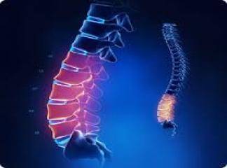lomber spinal stenoz egzersizleri