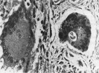 Mitokondrilerin Zedelenmesi 
