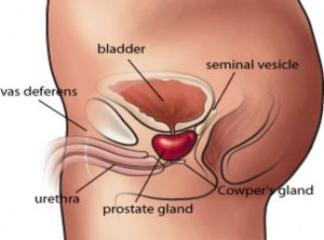 prostat kanseri nedir belirtileri nelerdir