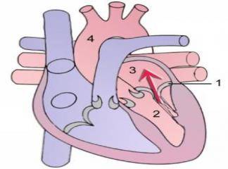 Sağ Kalp Yetersizliği Semptom ve Bulguları