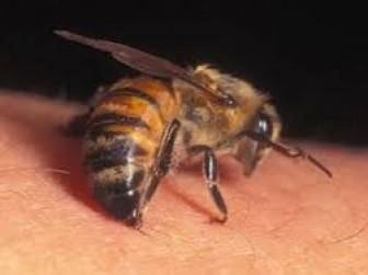 eşek arısı sokarsa ne olur