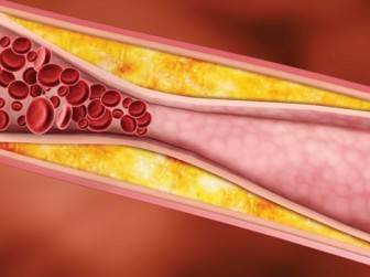 kolesterol nasıl düşürülür canan karatay