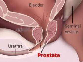 Prostat Rahatsızlıkları Belirtileri Nelerdir?