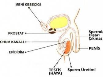 Sperm Kanalları Tıkanıklığı