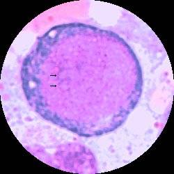 Hemocytoblast